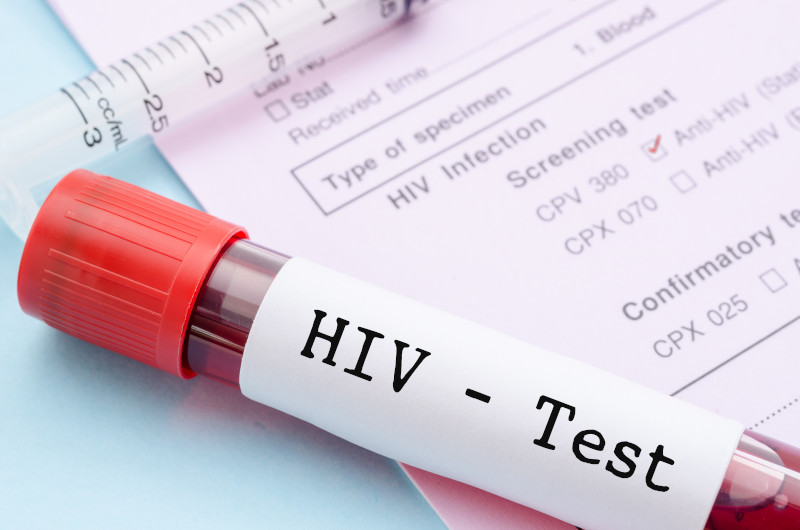 HIV/AIDS-Test